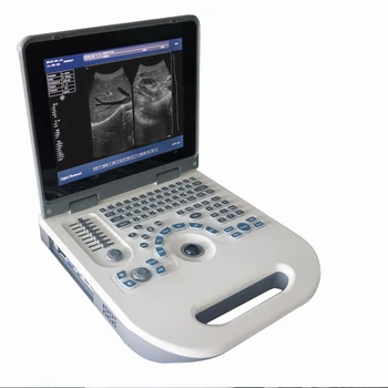Цена ультразвукового аппарата для портативного ноутбука Yun YiPortable Full Digital Ultrasound Scannerportable Цена ультразвукового аппарата